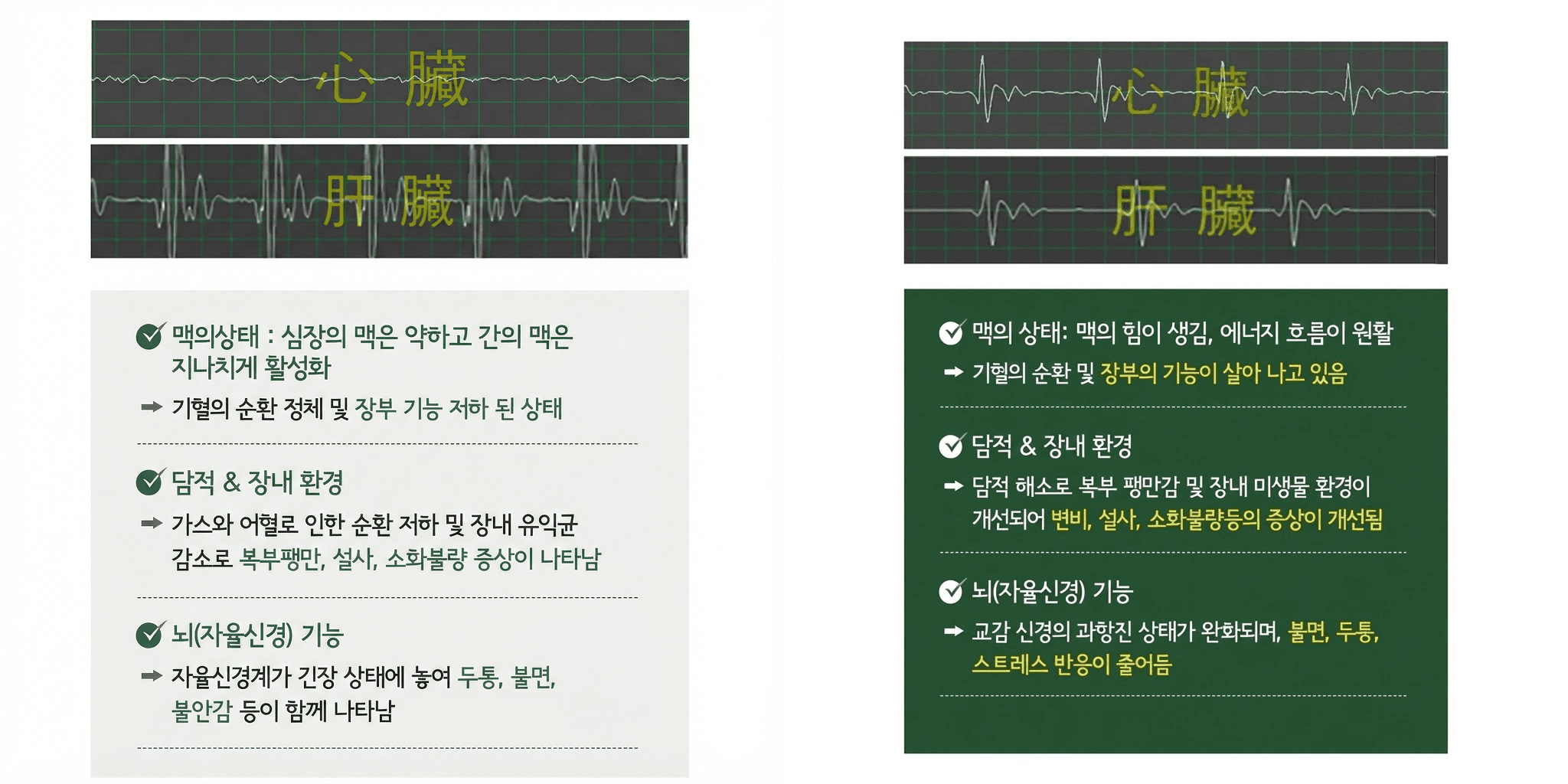 맥파검사 치료 전후