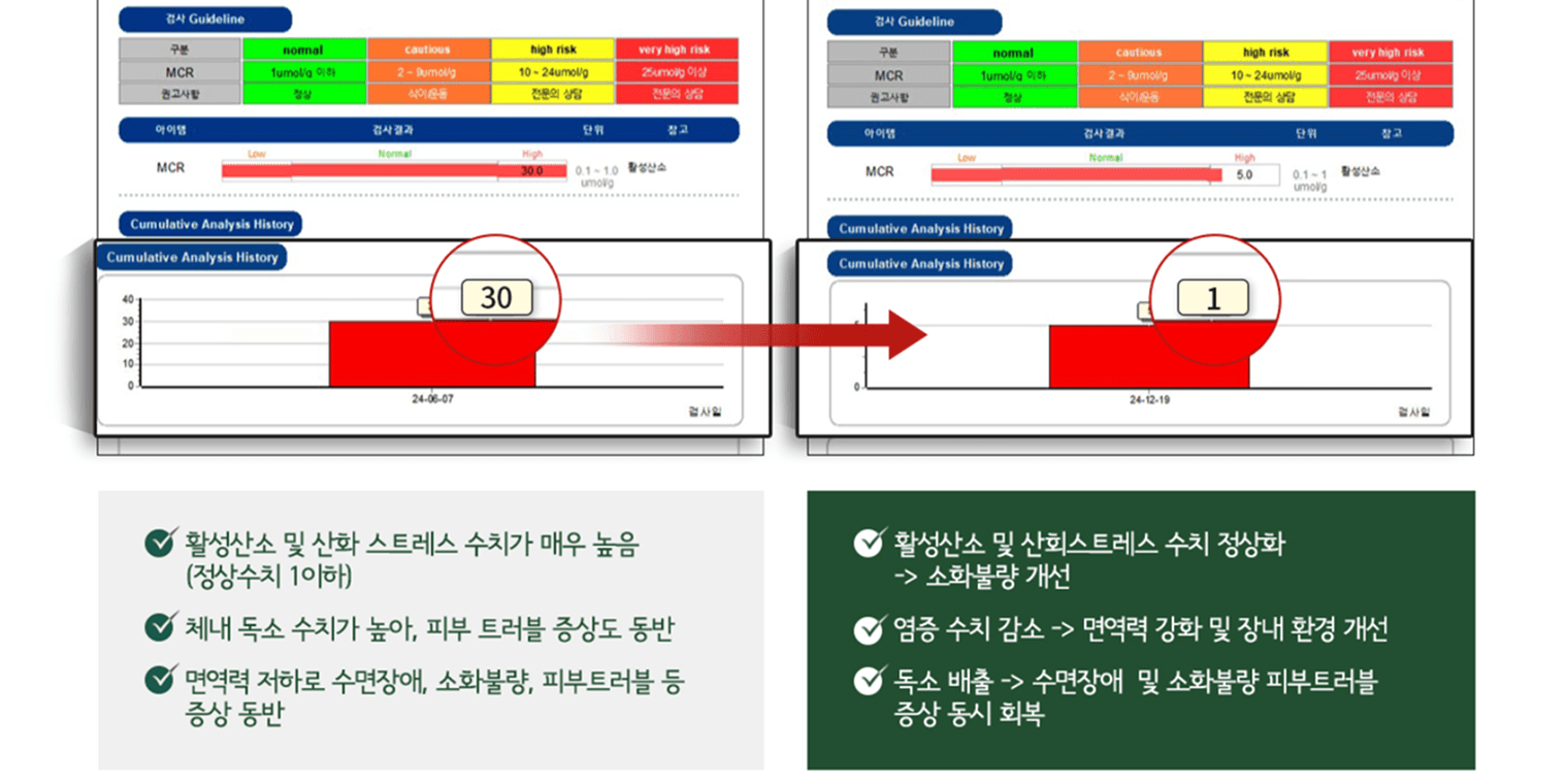 활성산소검사 전후